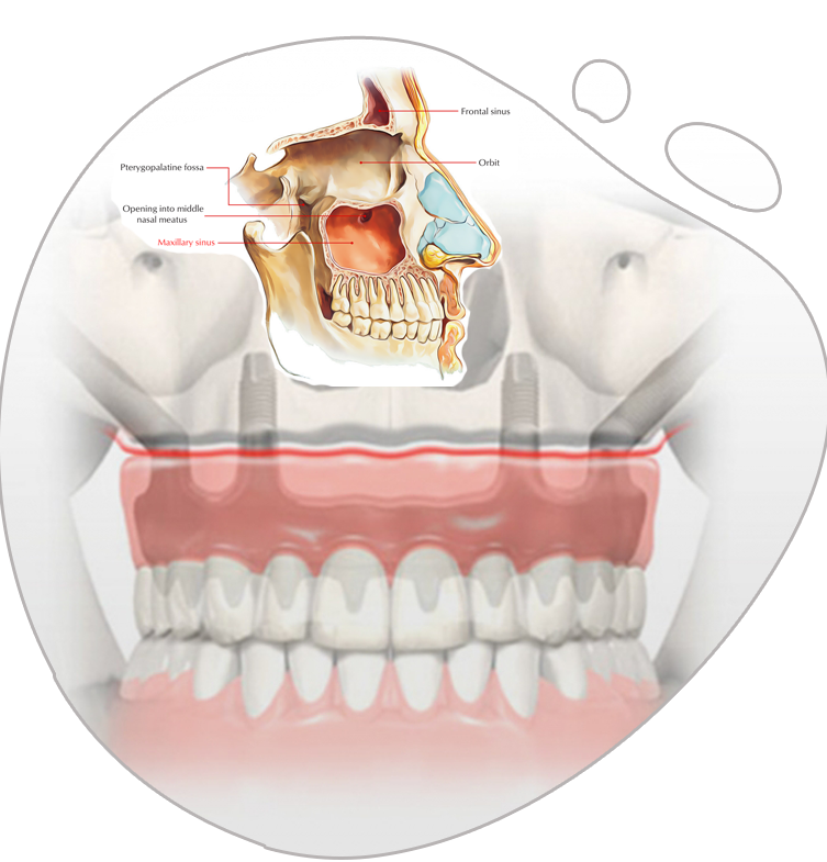 https://www.magizhchidental.in/wp-content/uploads/2021/02/Zygoma-img.png