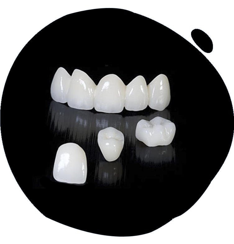 types and cost of dental crown