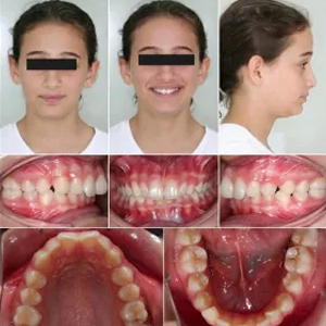 https://www.magizhchidental.in/wp-content/uploads/2021/02/invis-1.png