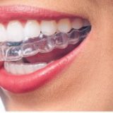 Invisalign-09-1