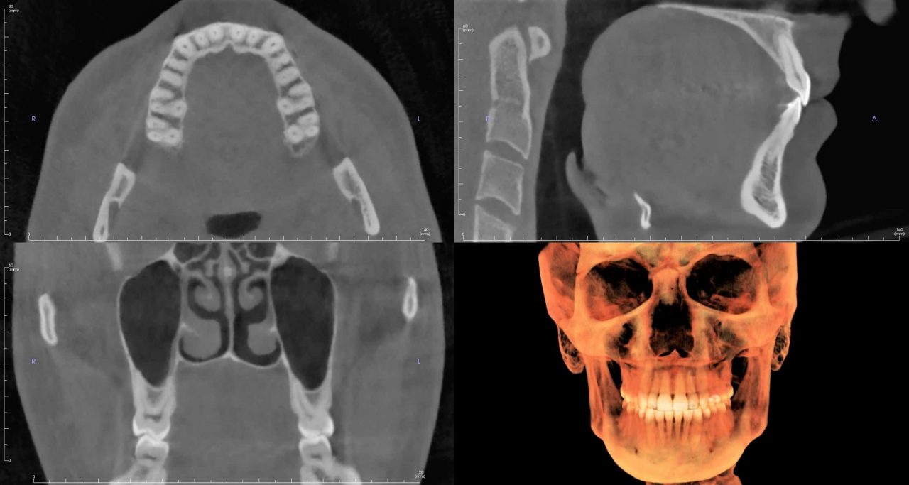 cbct image