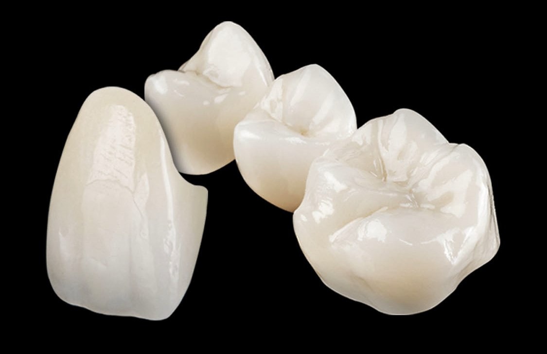 zirconia crowns