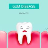 How to reverse gingivitis_
